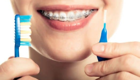 Brushing for Braces Wearers Daily Mistakes That Leave Plaque Behind